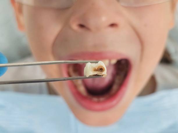 Best Dentist for Severe Toothache  in West University Place, TX